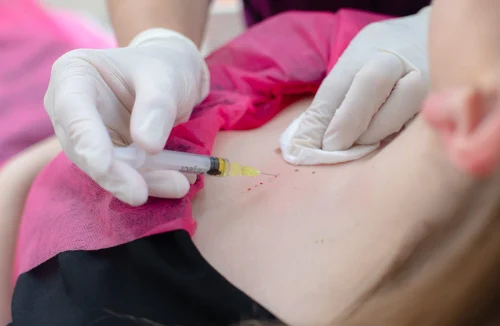 Mezoterapia corporală