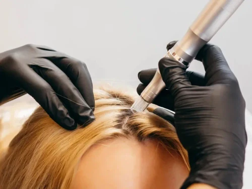 DermaPen Scalp