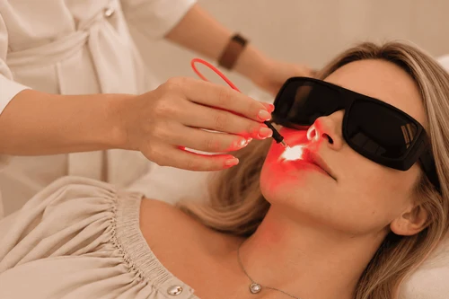 Weber Laser Treatment for Herpes