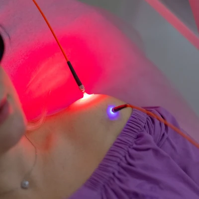 Acupunctura cu laser Weber