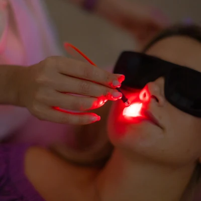 Tratamentul herpesului cu laser