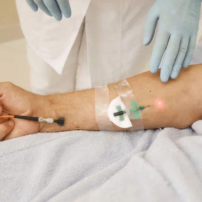 Terapia Laser Intravenoasă Weber